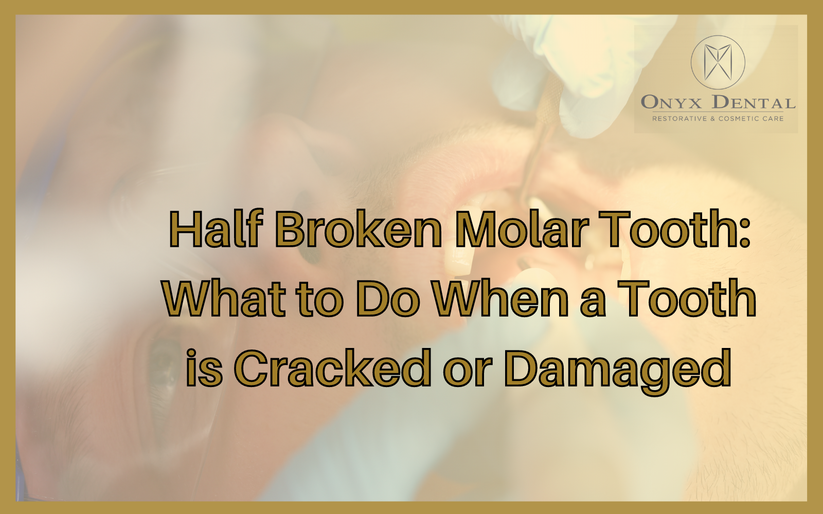 Half Broken Molar Tooth What to Do When a Tooth is Cracked or Damaged