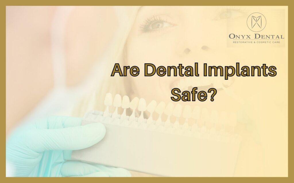 Are Dental Implants Safe