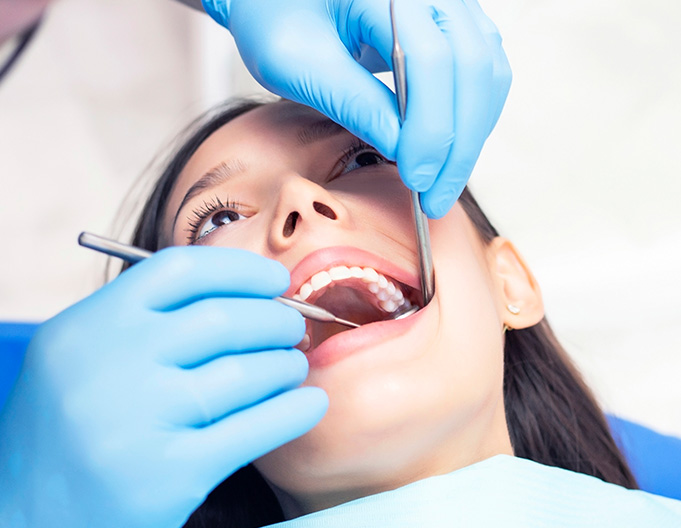 Wisdom Teeth Removal - Onyx Dental