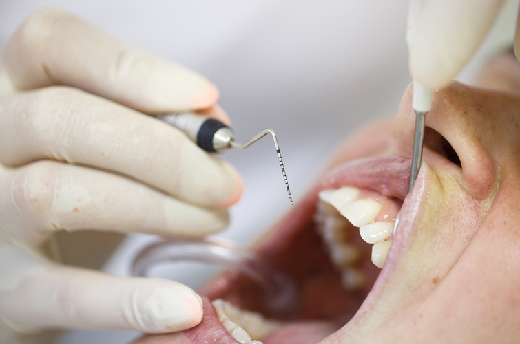 Seeking Immediate Relief: 5 Reasons To Get Emergency Wisdom Teeth Removal - Onyx Dental