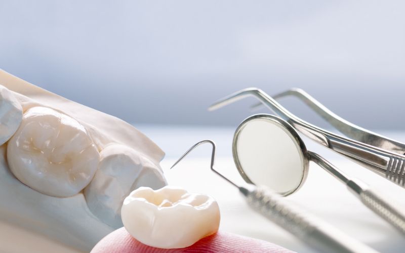 What is a Dental Crown