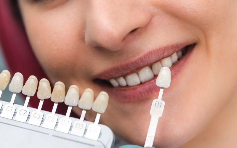 dentist using shade guide beautiful smile woman mouth check process