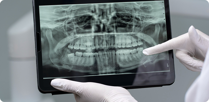 Dental Imaging - Onyx Dental